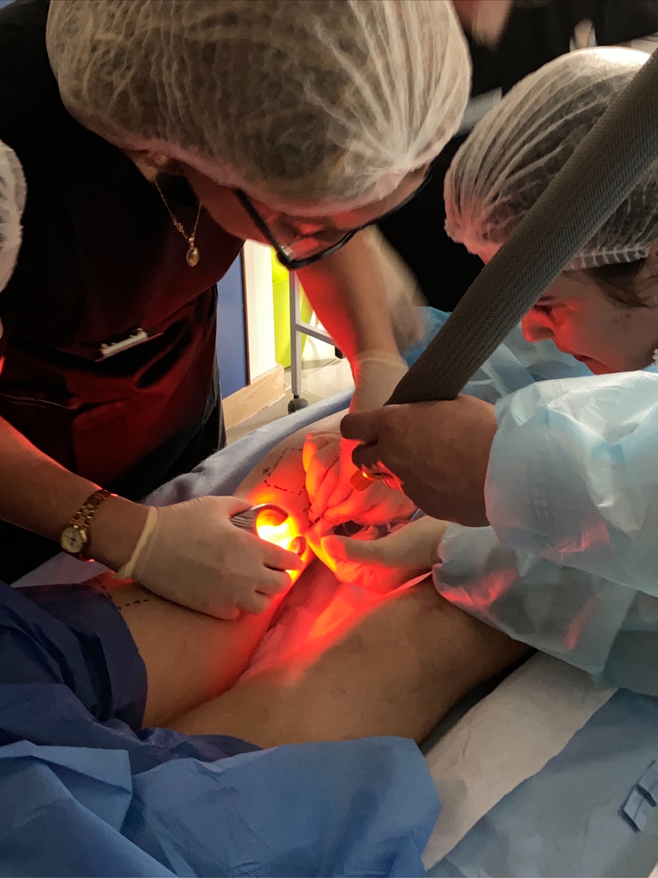 Hands-on sclerotherapy training procedure at AdventHealth Nicholson Center